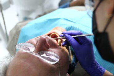 Temps de Cicatrisation d’un Implant Dentaire en Tunisie